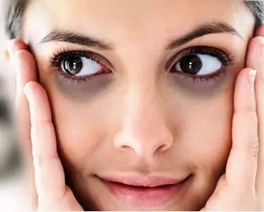 眼袋重黑眼圈教你一招轻松改善,天生眼袋黑眼圈该怎么消除