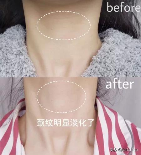 去细纹哪款眼霜值得入手百元内,又方便又好用的一款眼霜