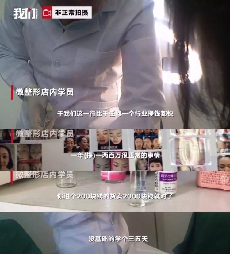 微整形大骗局揭秘,微整形美丽背后的陷阱美国