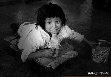 眼球被挖的人后续,眼球被挖了还能医吗