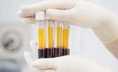 面部皮炎怎么辨证,面部特异性皮炎怎么治疗