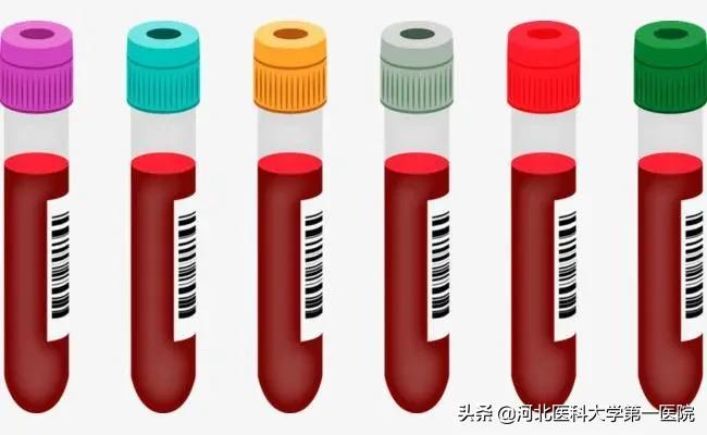 什么才是真正的空腹血糖,空腹检查知识你知道哪些