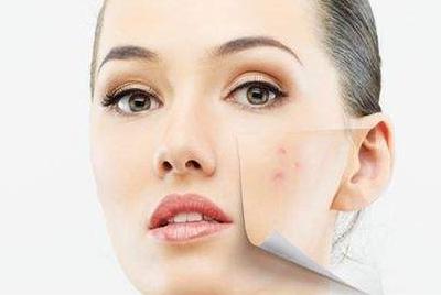 教你4个祛痘印最有效的方法,怎么去痘印最快最有效最简单