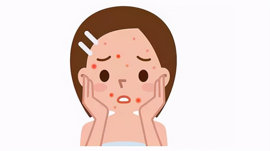 如何快速去痘印简单有效方法介绍,教你如何快速祛痘印最有效的方法