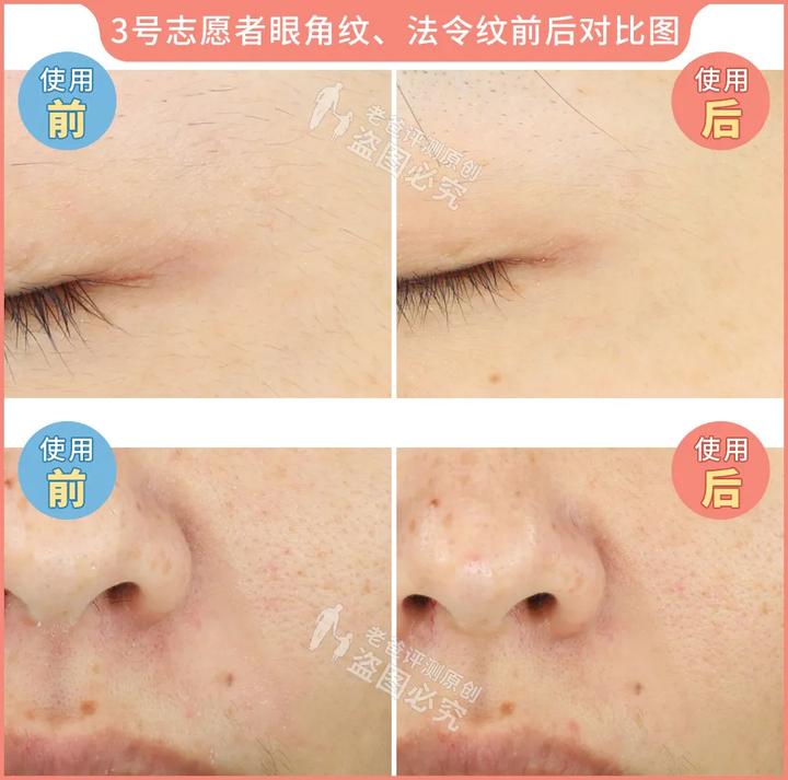 测评家用美容仪真的有用吗,网红推荐的美容仪有用吗