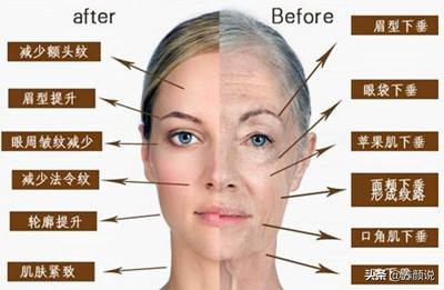 干皮如何淡化抬头纹和皱纹,去除抬头纹用什么护肤品