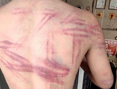 这个国家感染人数可能破5亿，上千万人或丧命