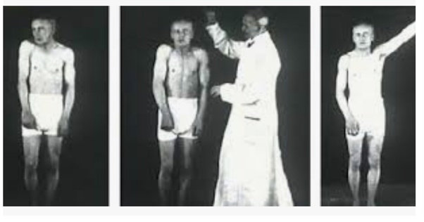 士兵被电击,德国士兵创伤性应激