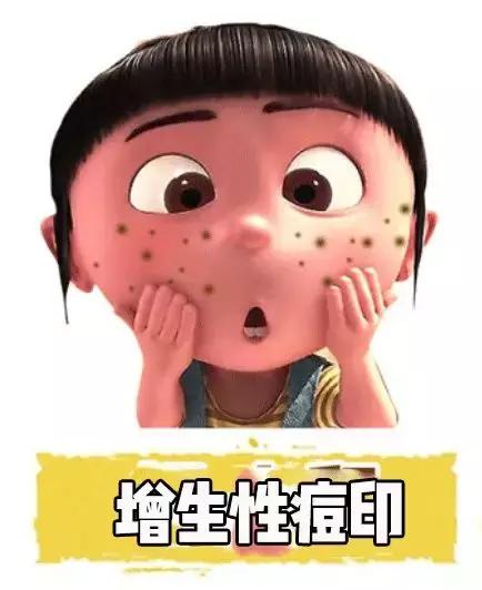 女生爆痘必买清单药膏,战痘效果最好的药