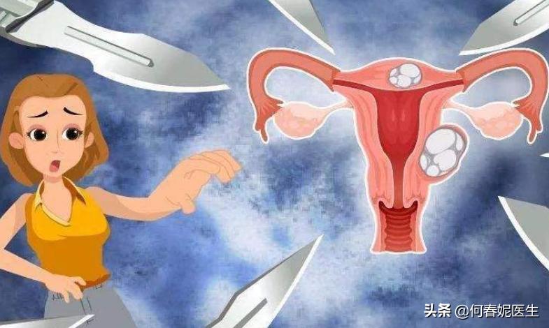警惕子宫肌瘤剔除术后复发！3种方式可有效预防