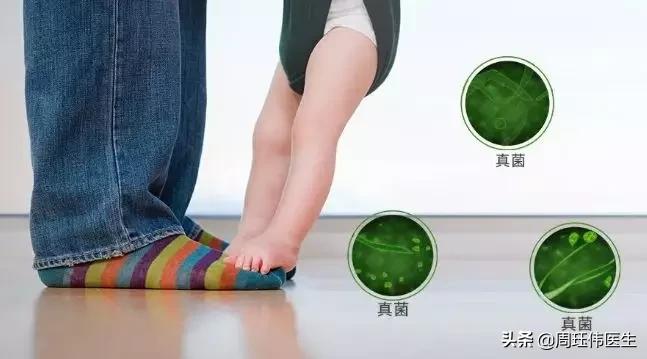 灰指甲和脚气哪个传染性强,疥疮和灰指甲哪个传染性强