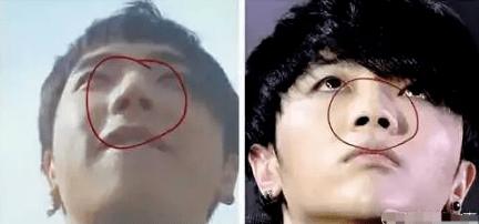 华晨宇植发的医院是哪里,华晨宇植发图片是真的吗