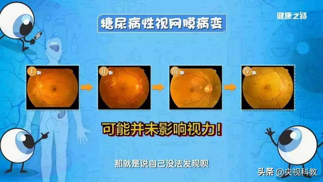 眼底照相全过程,拍一张眼睛的照片