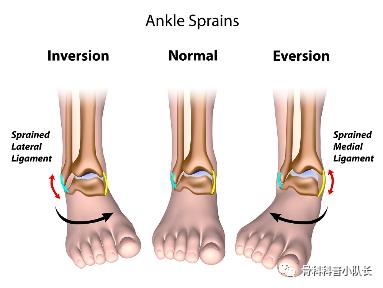 打篮球崴脚怎么处理热敷还是冷敷,崴脚超过48小时是热敷还是冷敷