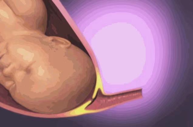 孕妇高清分娩全程图，从临产小征兆到正式胎儿娩出，早知道早准备