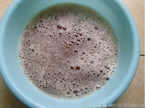 头皮上银屑病头屑洗不干净怎么办,头屑满天飞怎么治疗