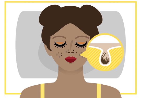 脸部t区出油特别厉害怎么办,脸t区总出油怎么改善