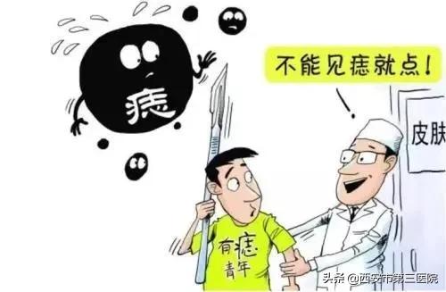 色素痣到底该不该去除,色素痣到底该不该去掉