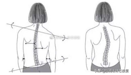 少儿不良体态纠正,少儿体态矫正最佳时间去哪里