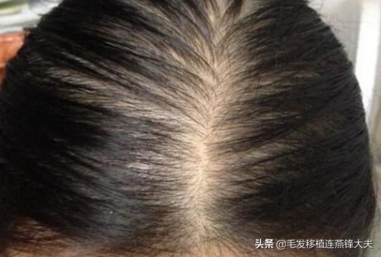 央视曝光洗发水黑名单是哪些,被毛发专家列入黑名单的洗发水