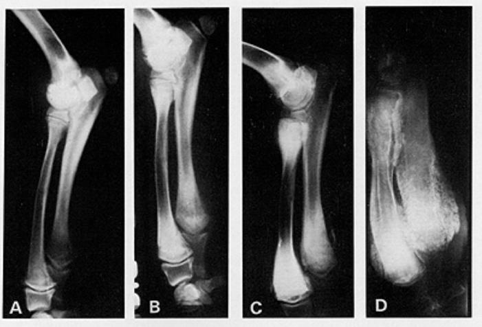 肥大性肌营养不良的症状表现,肥大性肌营养不良怎么办