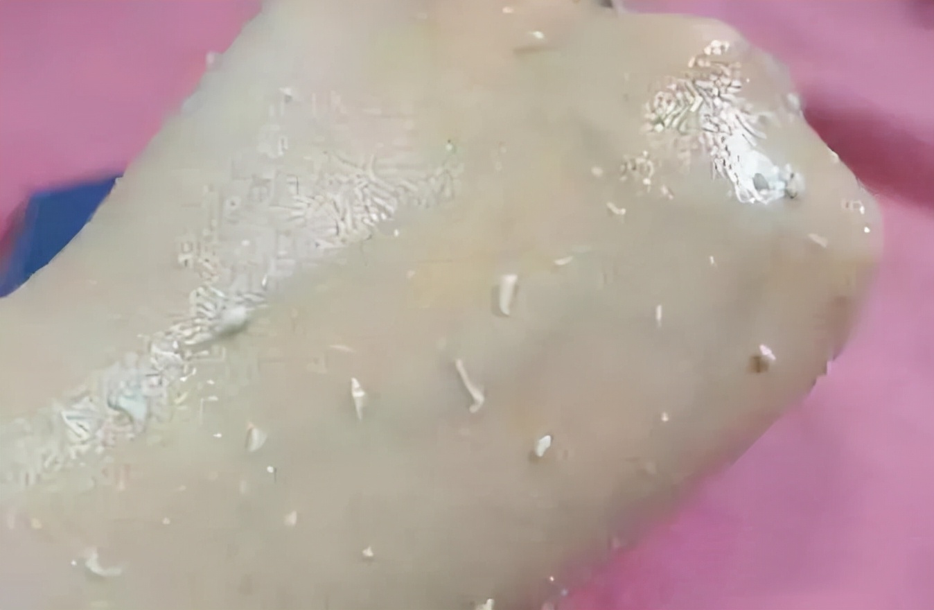 如何有效的去角质,去角质方法长期不去角质会怎样