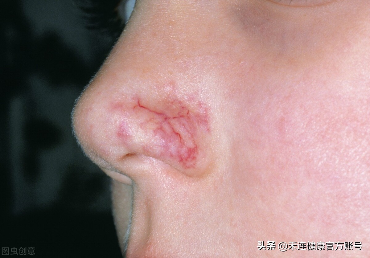 身上出现小红点是肝出现问题了吗,身上有小红点跟肝有关系吗