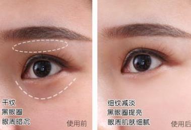 鱼子酱眼霜推荐淡化黑眼圈,鱼子酱眼霜精华抗皱