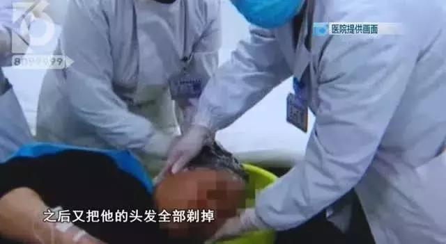 长沙一男子拿敌敌畏洗头,男子误拿敌敌畏洗头
