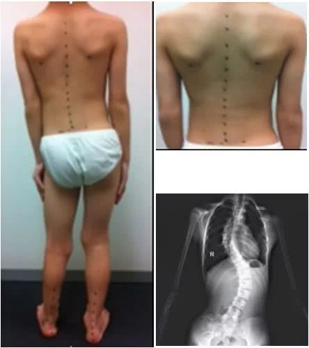 合脚的鞋只有脚知道,合脚的鞋子好吗