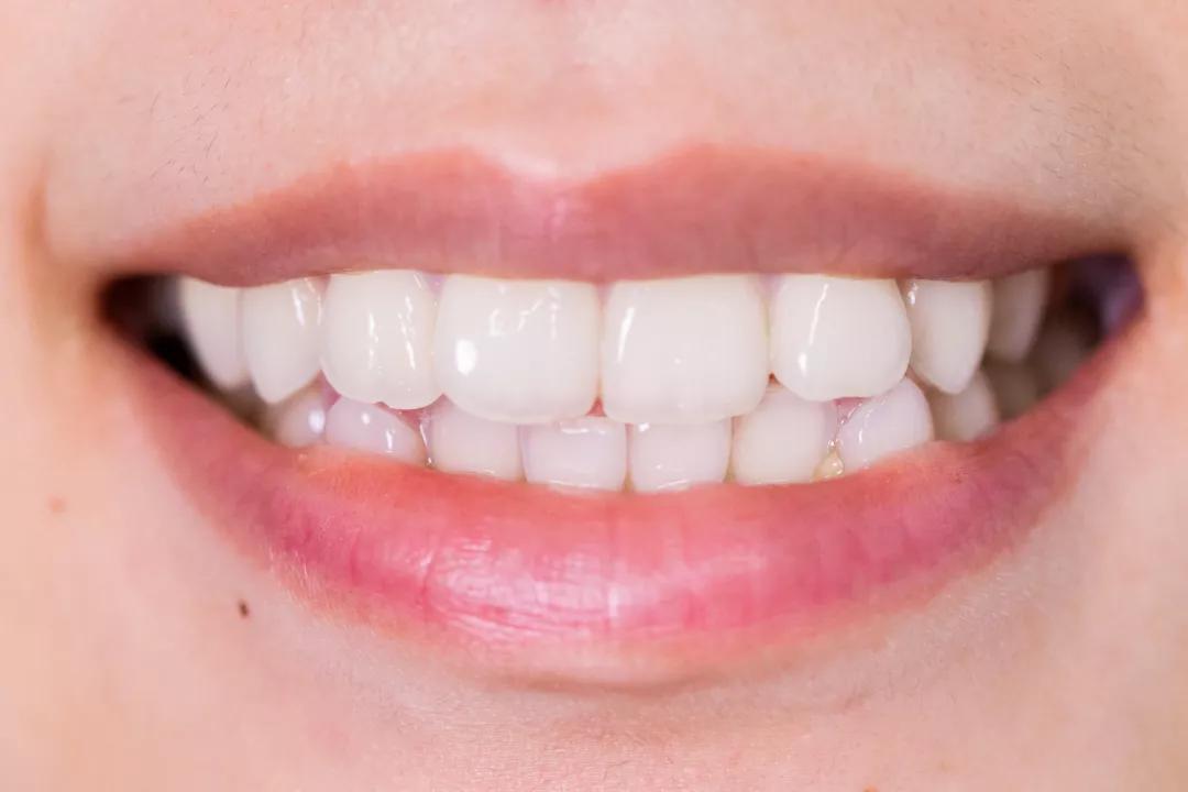 护齿儿童牙膏,护齿牙膏儿童防蛀牙