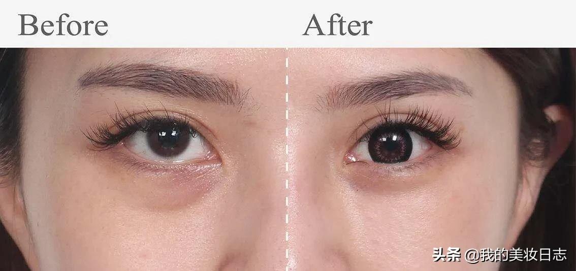 老人去眼袋妙招,老人去眼袋最有效的方法