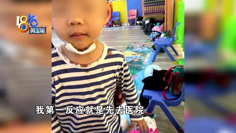 学轮滑摔破皮,儿童轮滑磕到下巴要多久恢复