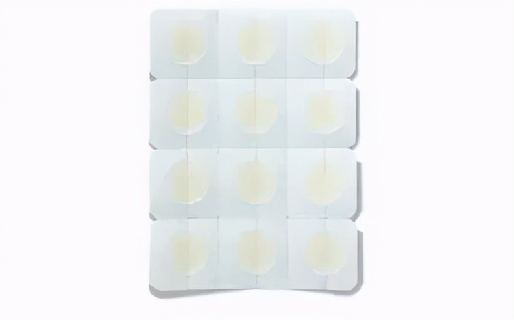 脸上长痘的几种原因,脸上长痘的三种原因