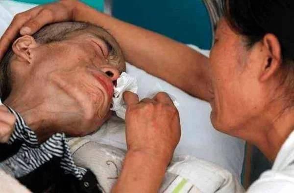 丙肝致肝癌的三大危险,有乙肝丙肝是不是容易得肝癌