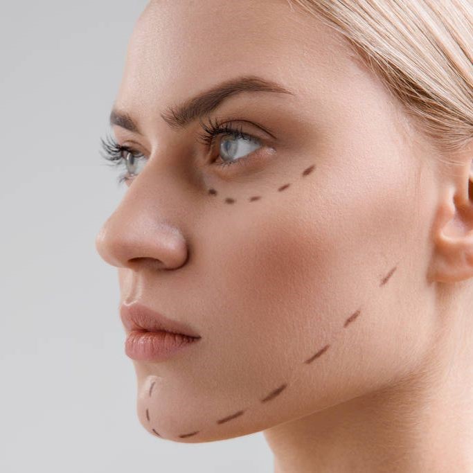 如何正确消除法令纹八字纹,法令纹显老10岁三种方法帮助改善