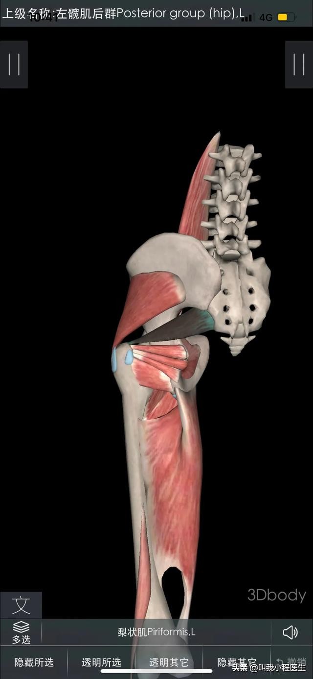 腰椎间盘突出骨质增生可以补钙吗,40岁腰椎间盘突出骨质增生怎么办