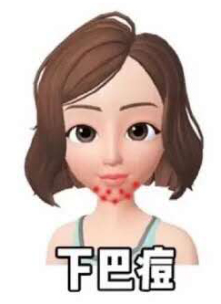 鼻翼两侧和下巴长痘什么原因引起,脸颊两边长痘是什么原因该怎么办