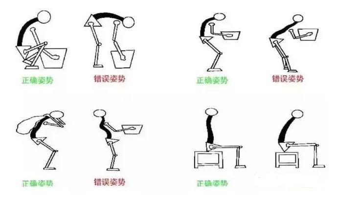 椎间盘突出预防和缓解,极外侧型椎间盘突出