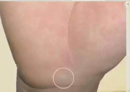 手诊10种常见病从手上就能看出来,如何辨别手掌的健康