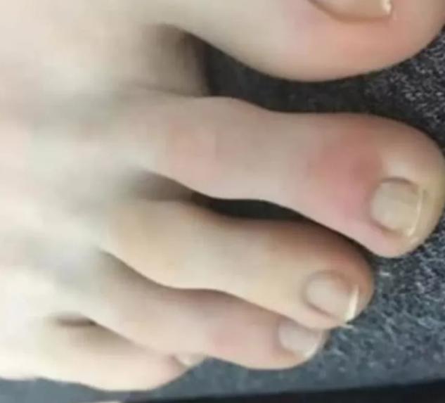 哪些国家有儿童感染新冠病毒的,现在新冠病毒儿童最新症状