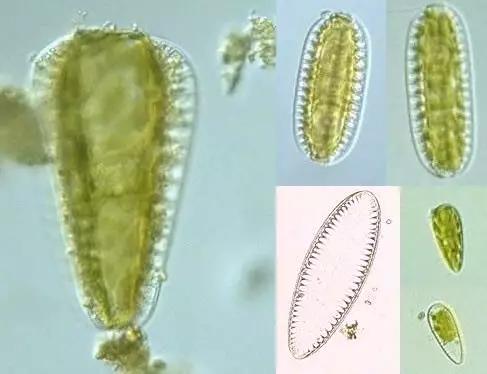 水产养殖藻类老化是怎样的,水产养殖显微镜下各种藻类