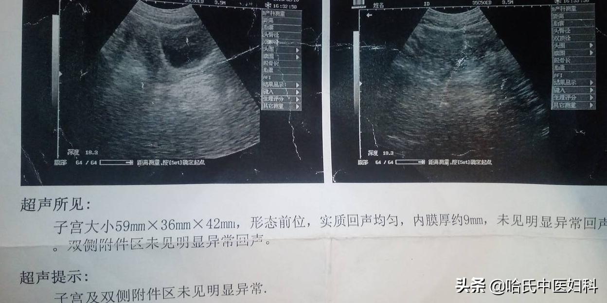 女性患有多囊卵巢不孕不育怎么办,女性卵巢性不孕怎么办