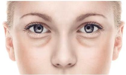 45岁女人适合做哪种祛眼袋方法,生姜祛眼袋的正确方法