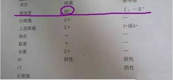 孕中期分泌物有褐色早产几率大吗,孕28周有浅褐色分泌物会早产吗