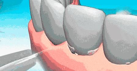 快看！这家店拯救了90%汕头人的牙齿烦恼