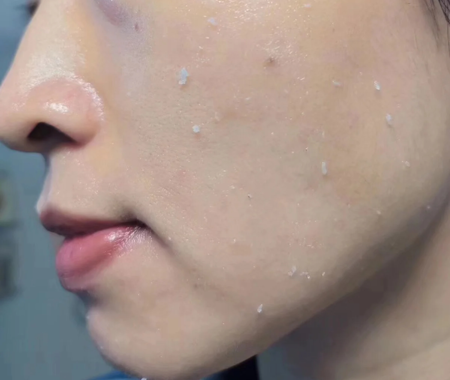 容易搓泥起皮的护肤品正确用法,护肤品用了搓泥什么原因