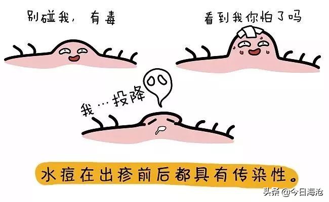 科普水痘来袭请做好战斗准备,水痘处于高发期请做好战痘准备