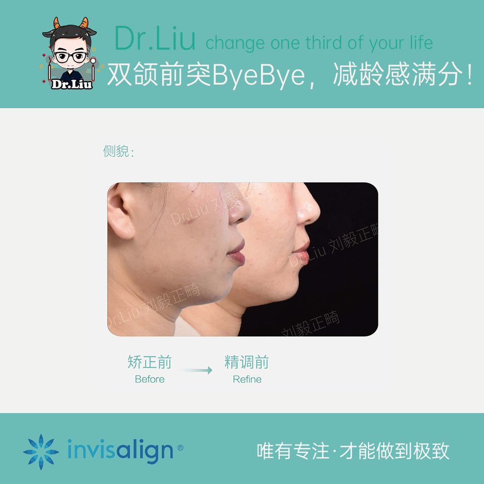 鍘﹂棬鐗欓娇缇庡,鍘﹂棬鐗欓娇鐭闅愬舰姝ｇ暩