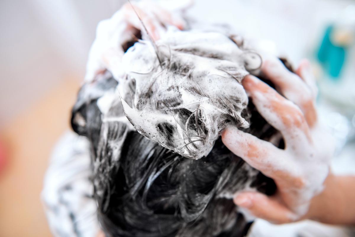 天天洗头头皮屑多像雪花解决办法,天天洗头还有头皮屑头皮发痒脱发